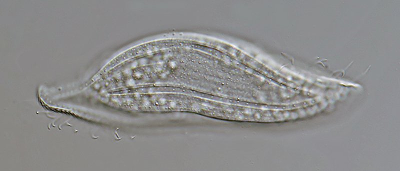HWS Loxophyllum helus 04 - 125 µm 800.jpg