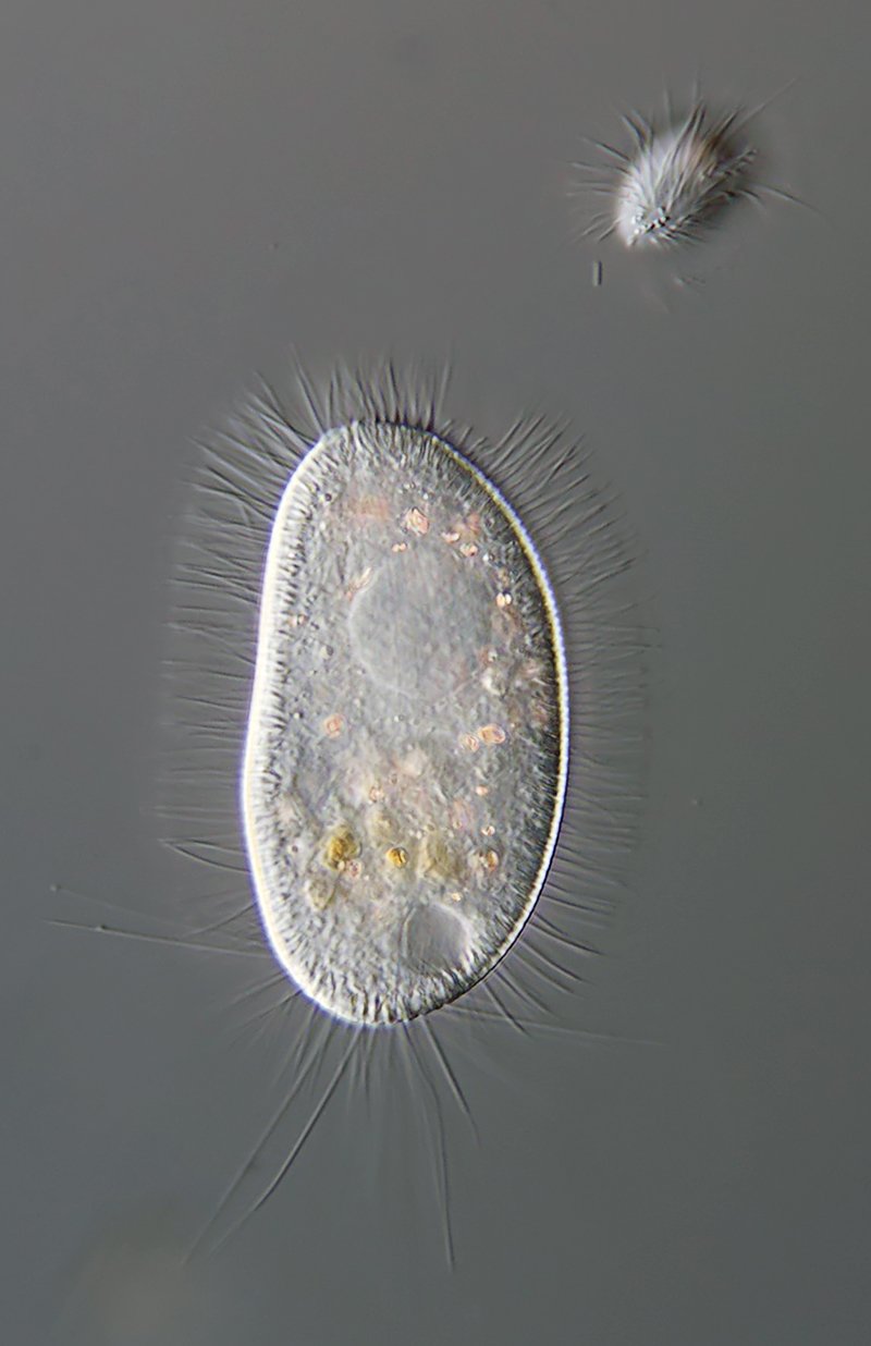 HWS Pleuronema coronatum 06 - 75 µm 800.jpg