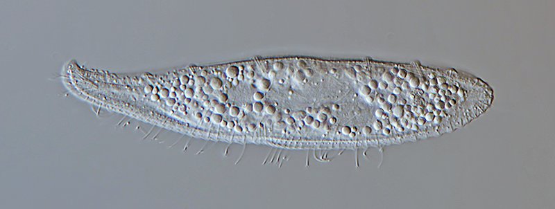 HWS Loxophyllum helus 01 - 125 µm 800.jpg
