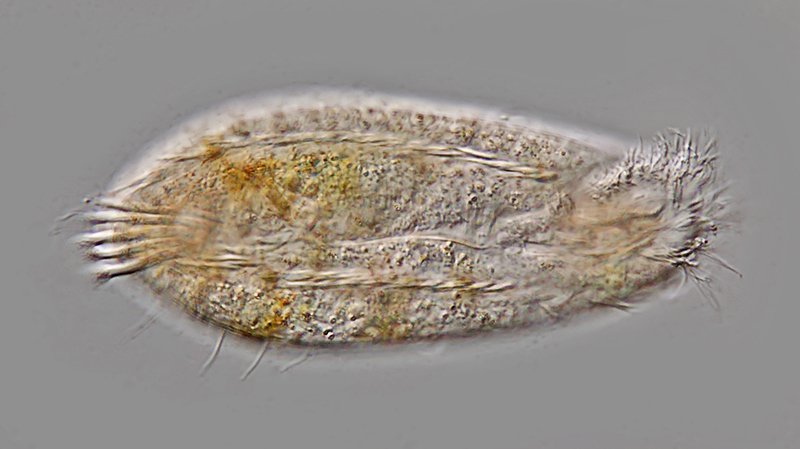 HWS Holosticha (Amphisiella) milnei 01 - 113 µm 800.jpg