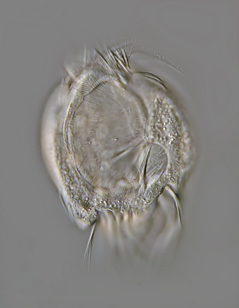 HWS Uronychia transfuga 02 - 125 µm 800.jpg