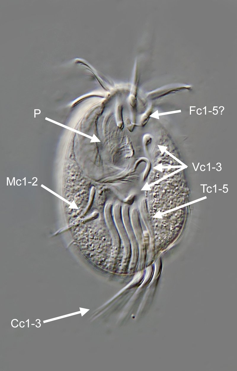SL Diophrys appendiculata 02B - 80 µm.jpg