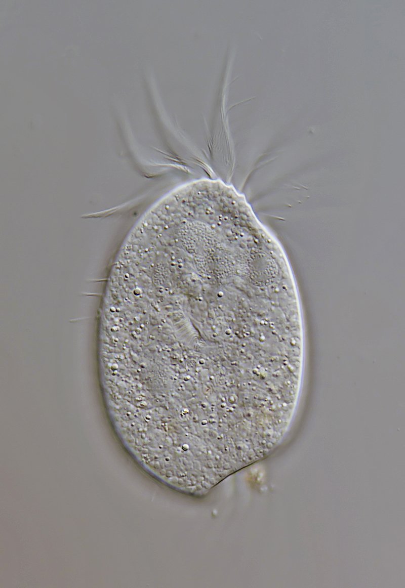 SL Diophrys appendiculata 03 - 80 µm.jpg