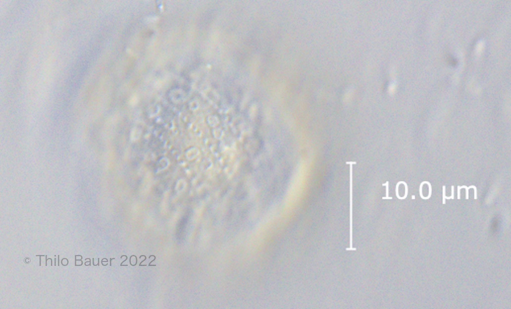 Tetrahymena-cyst-big.jpg