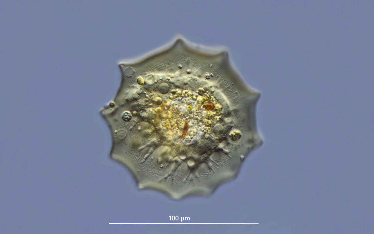 Pyramiden-Uhrglastier Arcella conica DIK 50-Z7.jpg