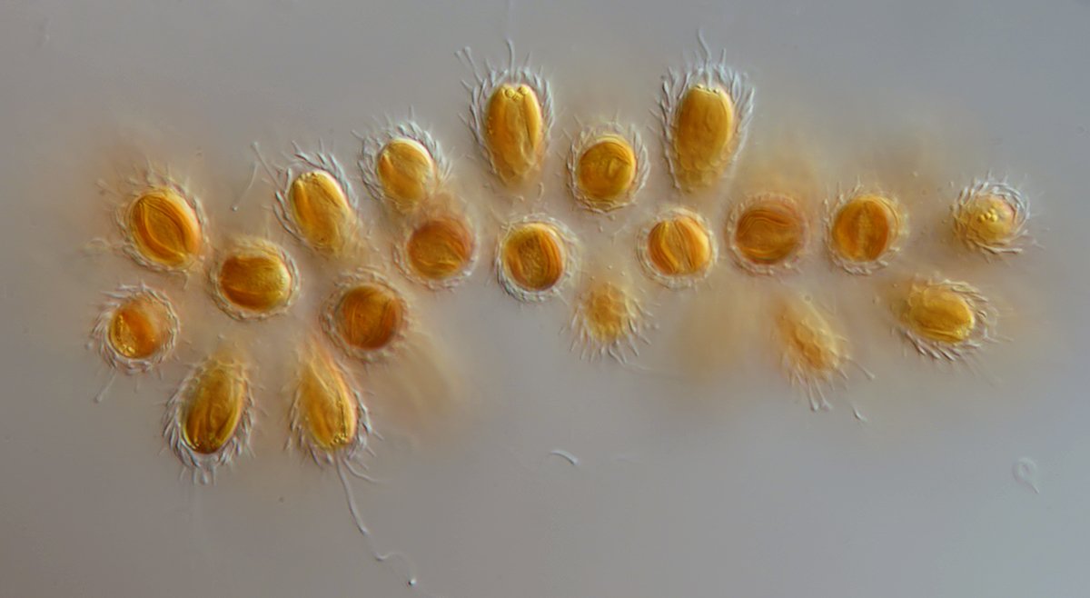 DG Synura sp. 04 - 10x15 u. 120 µm.jpg