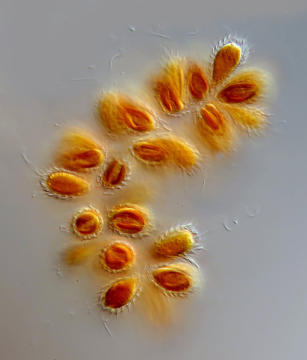 DG Synura spinosa 01 - 10x15 µm.jpg