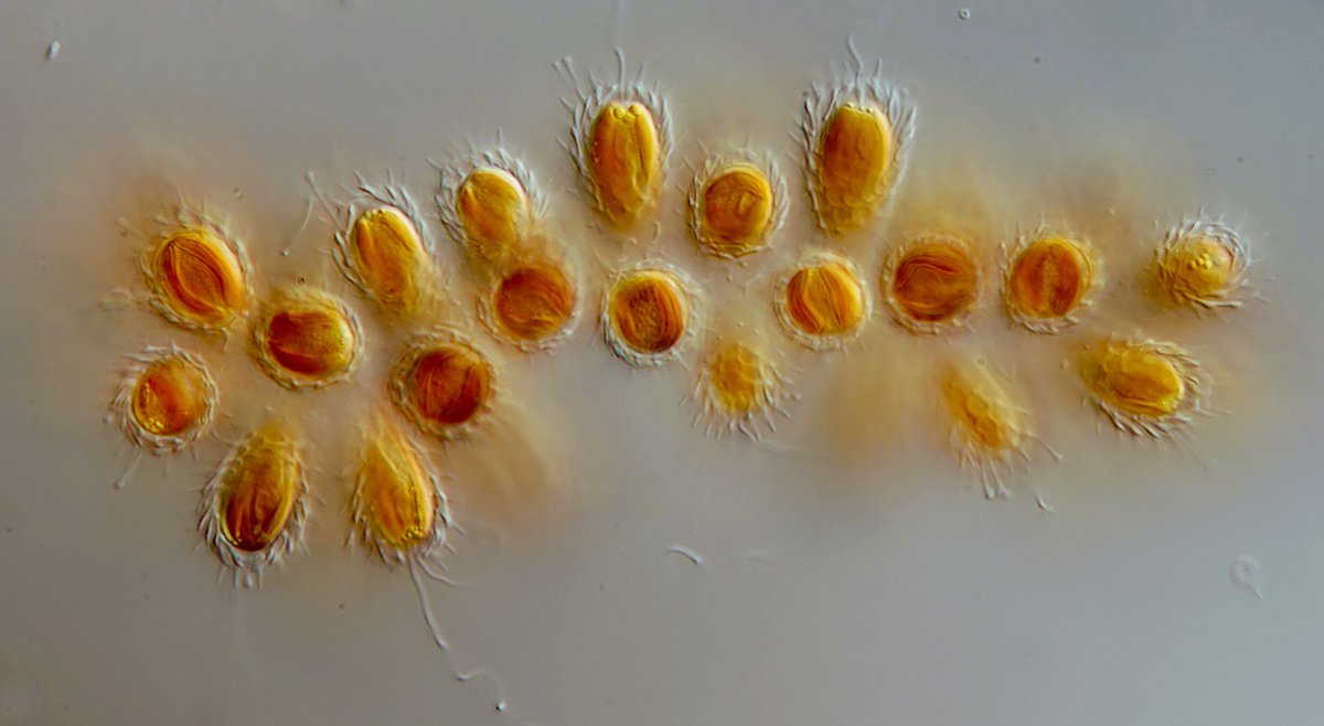 DG Synura spinosa 02 - 10x15 µm.jpg