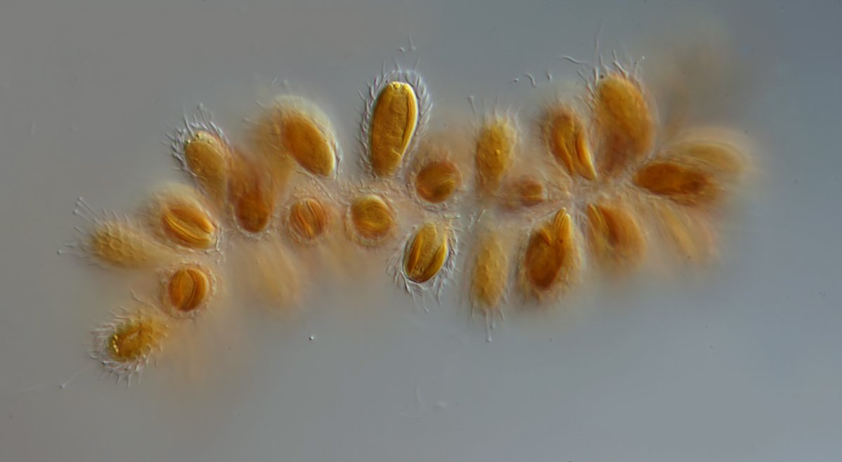DG Synura spinosa 03 - 10x15 µm.jpg