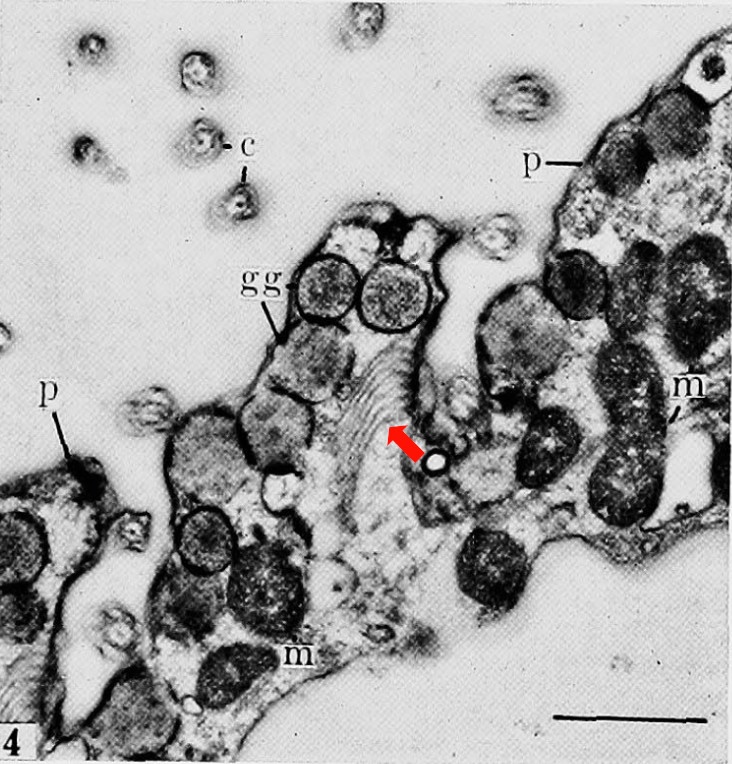Blepharisma-electron-microscopy.jpg