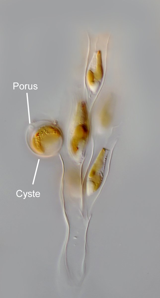 AT Dinobryon sertularia 03B - 40-45x12-14µm - Cyste 20µm.jpg