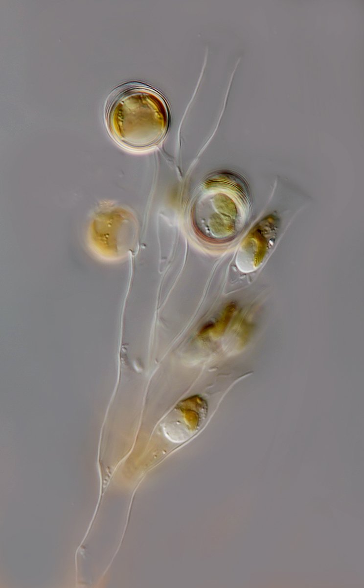 AT Dinobryon sertularia 05 - 40-45x12-14µm - Cyste 20µm.jpg