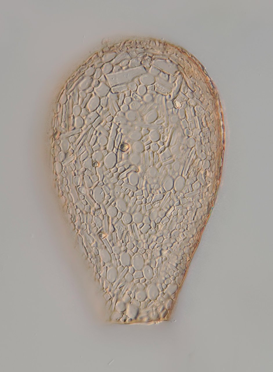 Nebela collata.jpg
