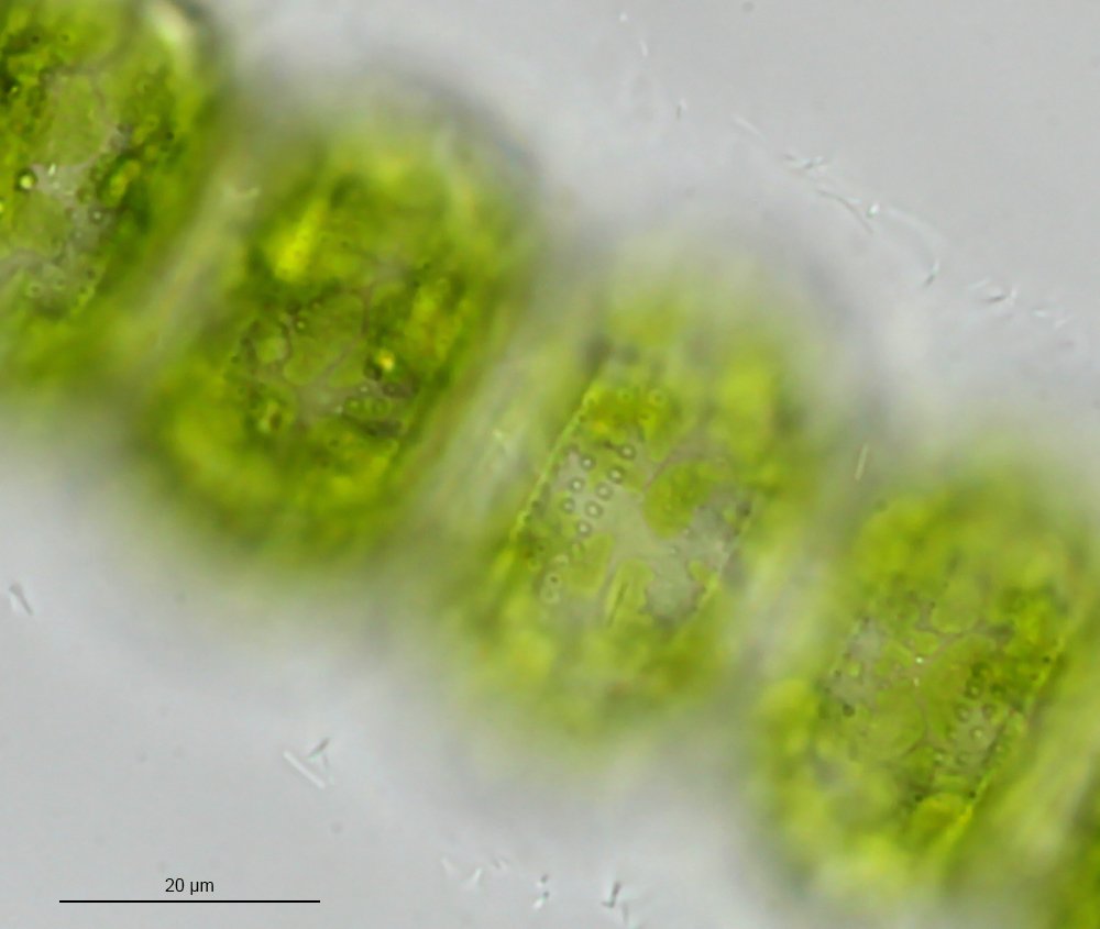 Desmidium_grevillei_ZeissRA_40_0,9_63mm_Kpl8x_Paradieswiese_30.07.2023a_1000.jpg
