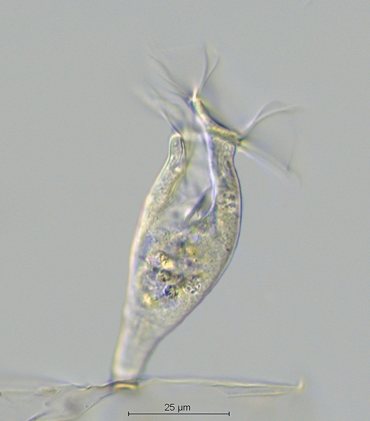 Vorticella spec. vs Epistylis spec..jpg