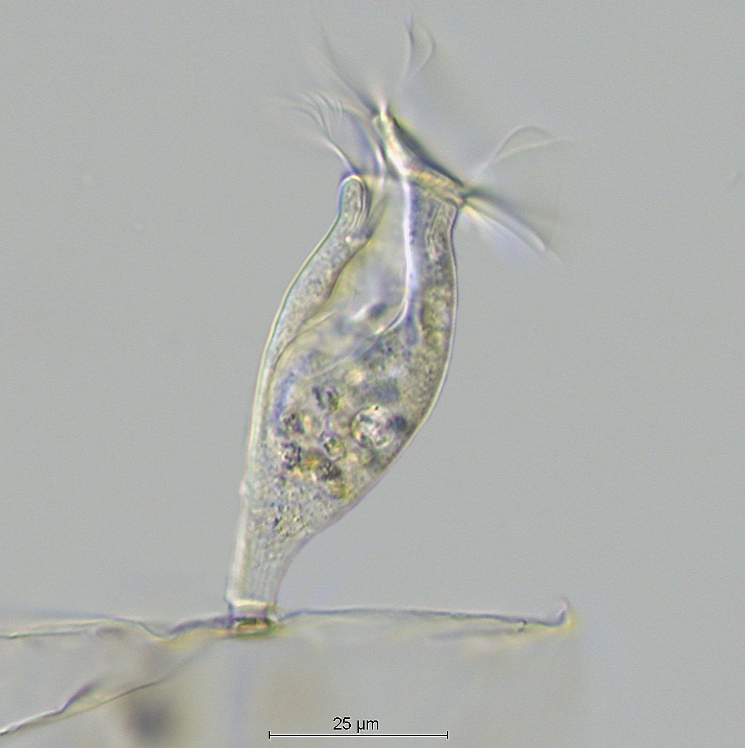 Vorticella spec. vs Epistylis spec..jpg