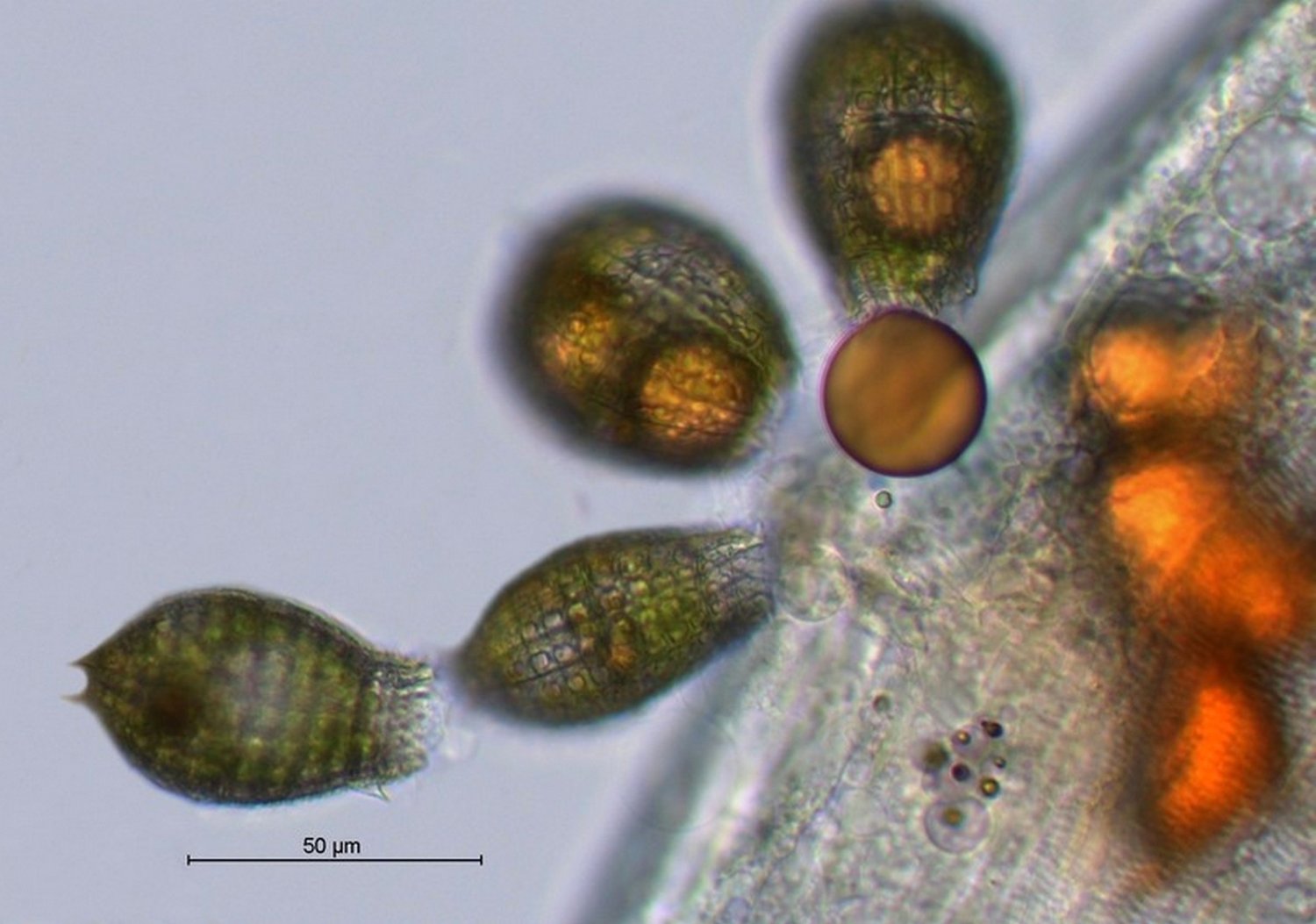 Coleps hirtus.jpg