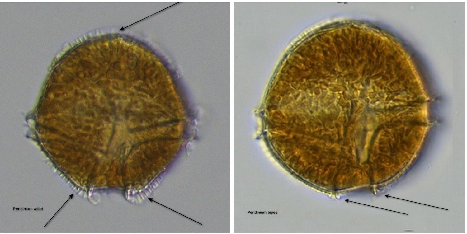 Peridinium spec..jpg