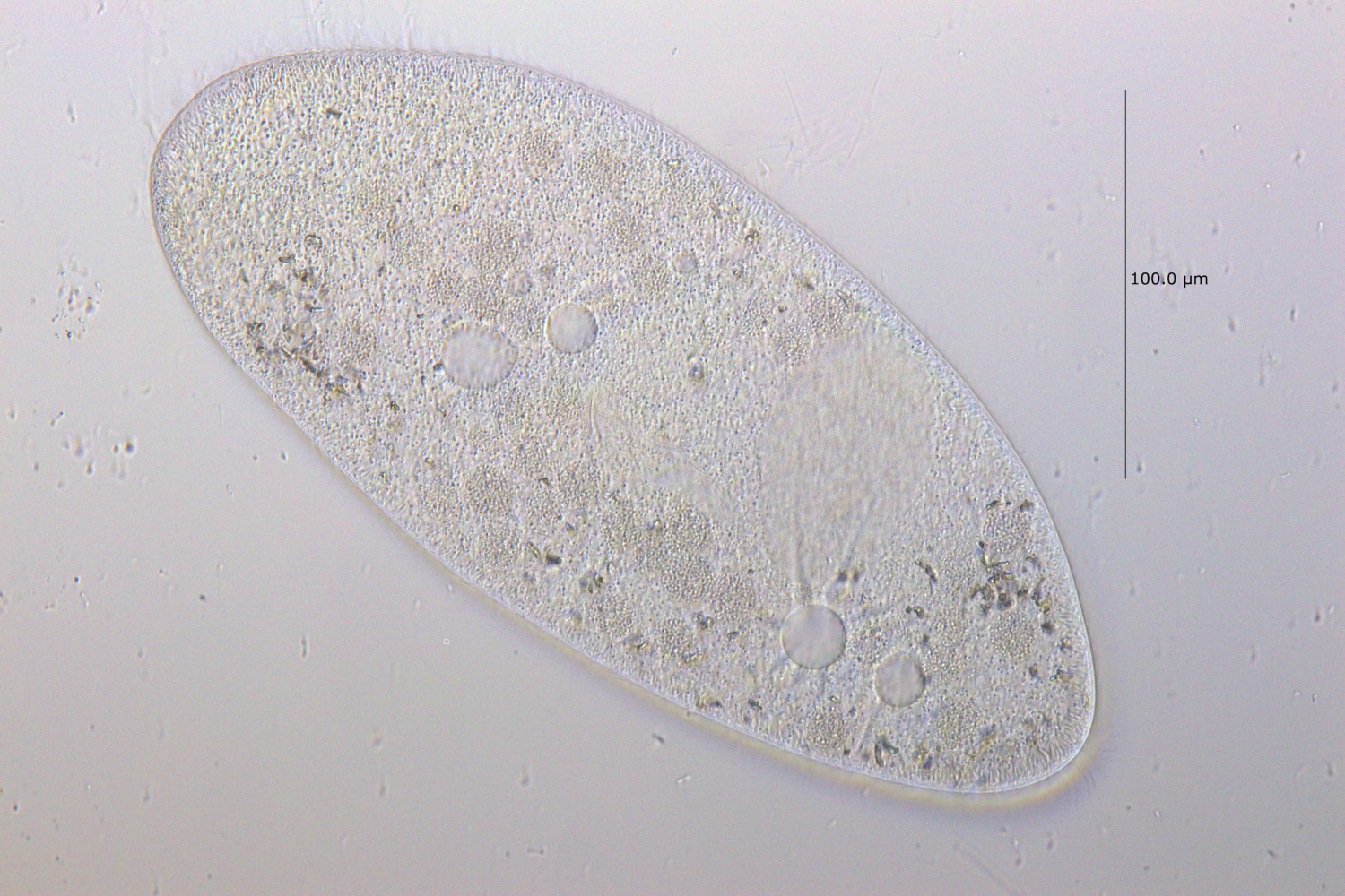 Paramecium_caudatum_HF_C-Apo-40x.jpg