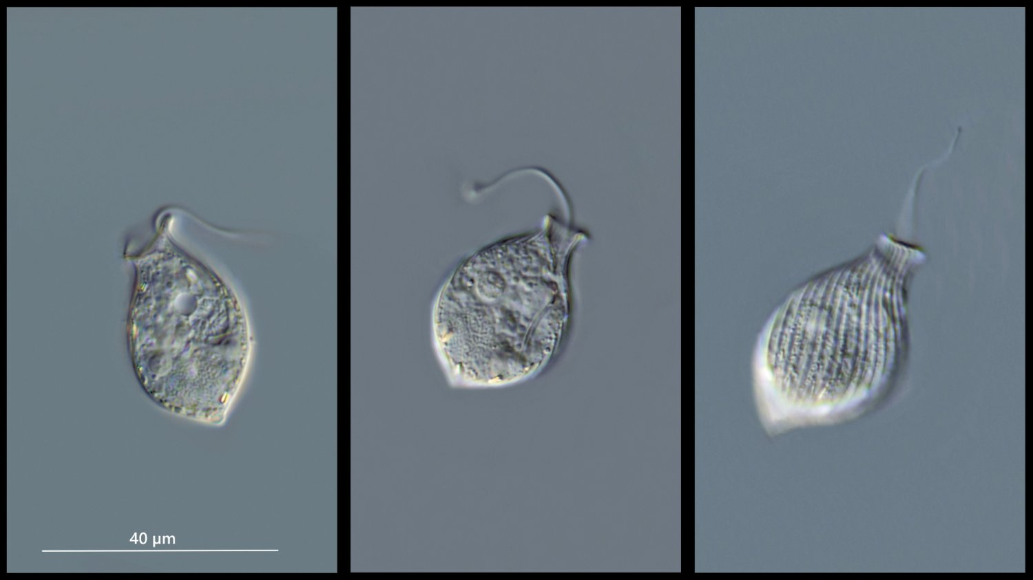 Urceolus 10 cyclostomus Krug-Flagellat DIK 100 Komp 3 Ebenen.jpg