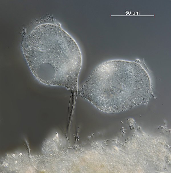 Hier sieht man vermutlich Vorticella aus dem infusorium Komplex. Aber es sind zu wenige<br />Details, um sicher zu sein.