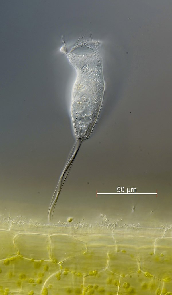 Hier sieht man vermutlich Vorticella aus dem octava Komplex. Aber es sind zu wenige<br />Details, um sicher zu sein. Das einzige Bild vom Nachklärbecken.