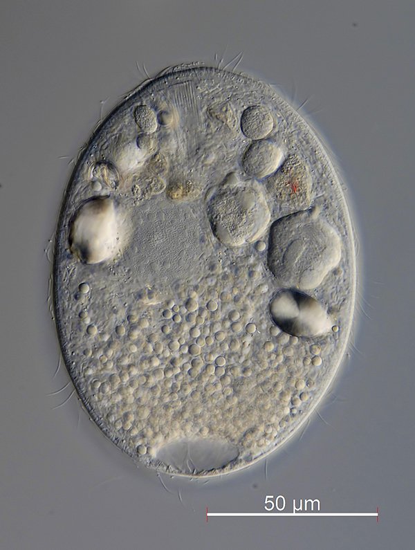 Holophrya discolor mit dem Mundfeld am Vorderende und der kontraktilen Vakuole am<br />Hinterende.