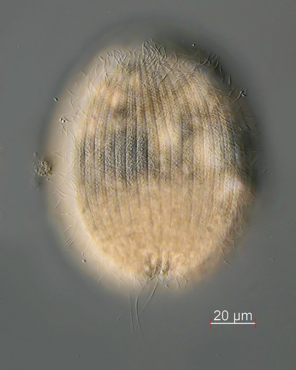 Holophrya discolor mit Fokus auf die Wimperreihen. Interessant ist, dass sich im oberen<br />Bereich eine Wimperreihe dichotom verzweigt.