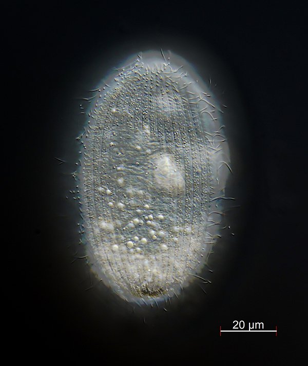 Holophrya discolor mit Fokus auf die Wimperreihen bei diesem Exemplar.