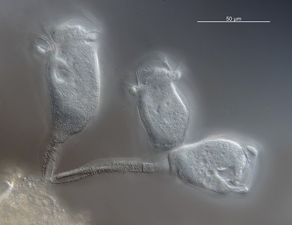 Mit hoher Wahrscheinlichkeit Carchesium polypinum. Erkennbar an dem unterbrochenen<br />Muskel im Stil.