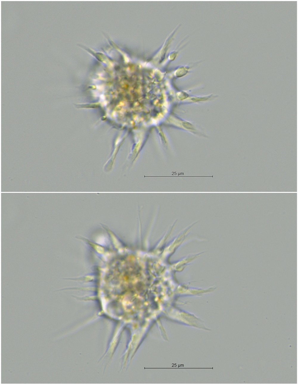 Amoebidae_4.jpg