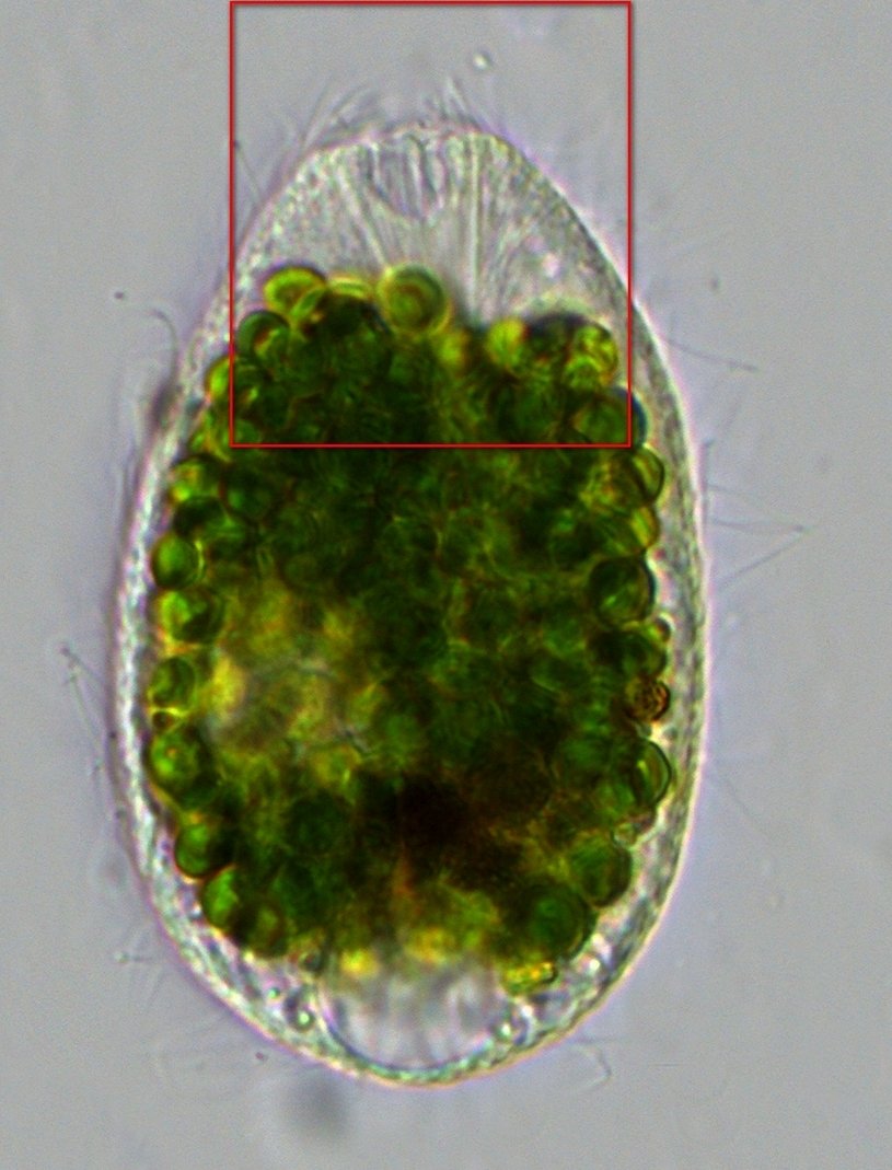 Ciliat_Image_6.jpg