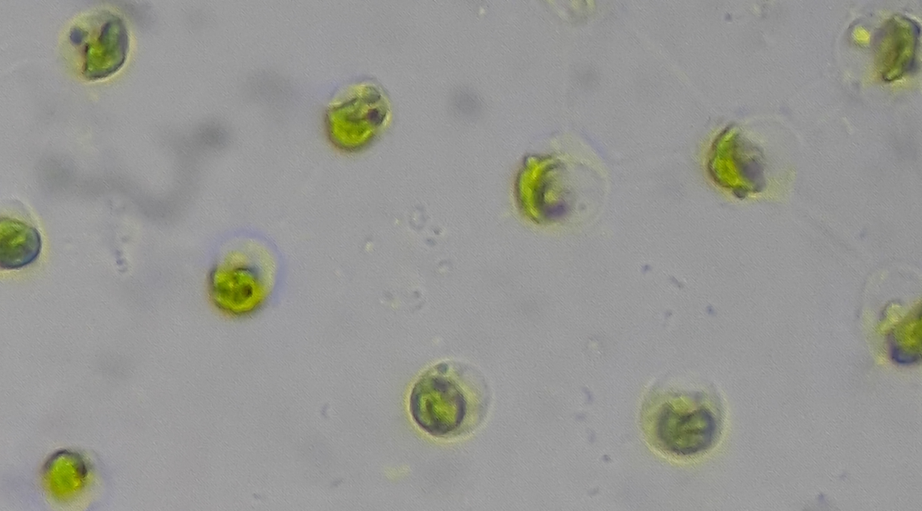 Volvox_Water_Zoom4.jpg