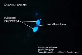 Abb. 3: Makro-/Mikro-Nuklei in UV-Anregung