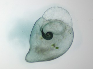 Stentor_coeruleus-1.jpg