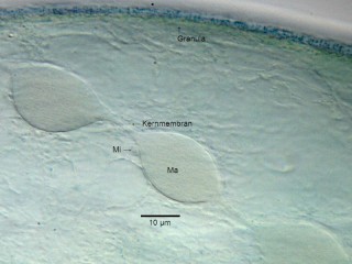 Stentor_coeruleus-3.jpg