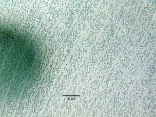 Stentor_coeruleus-5.jpg