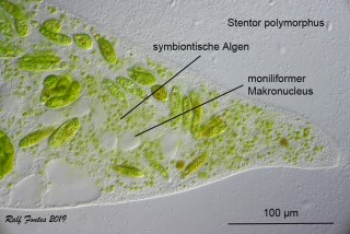 Stentor polymorphus detail 3 Text_2618.jpg
