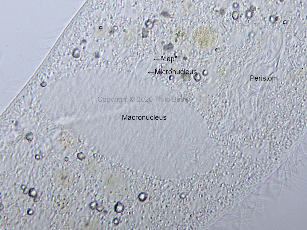 Bild 2: P. caudatum, lichtmikroskopische Details der Region der beiden Zellkerne.
