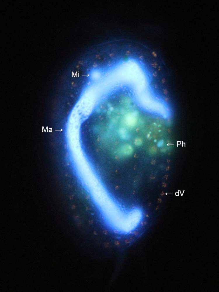 Kontrastierte, länger belichtete Aufnahme in Fluoreszenz.