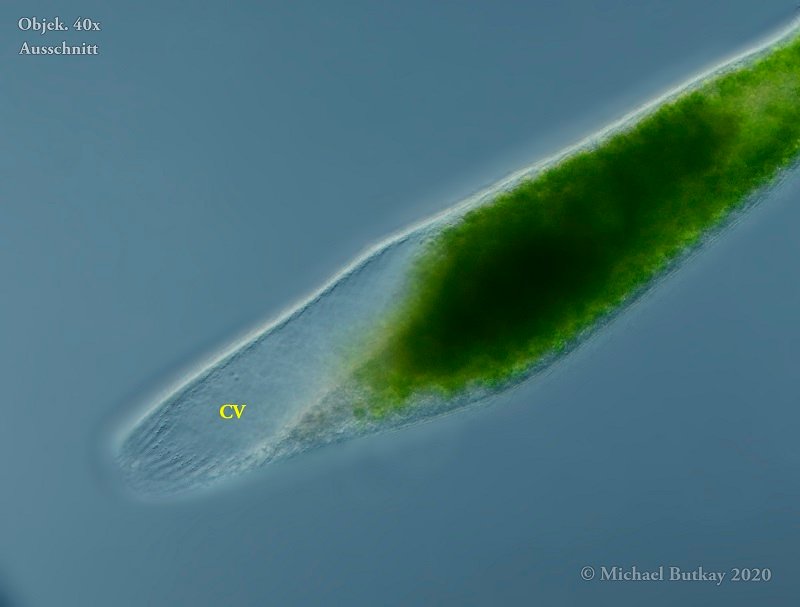 Bild 7_Spirostomum semivirescens_i4a5322_05-04-2020b.jpg