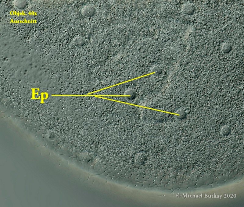 Ep = Exkretionsporus einer kontraktilen Vakuole sind sehr klein und leicht zu übersehen.