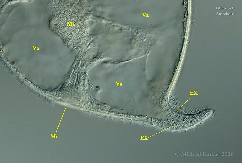 E = Extrusome (Toxicysten), Ma = Makronucleus, Mt = Mundtrichter, Va = Vakuolen