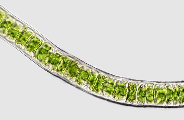 ulothrix.tenuissima1a.jpg