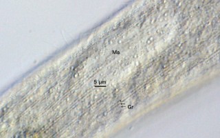 Spirostomum teres: Dicht unter der Pellicula findet man Reihen feiner Granula.