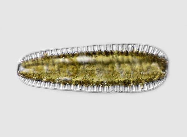 surirella.robusta1.jpg