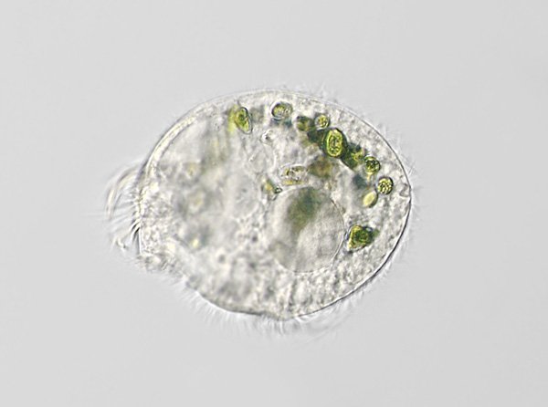 ciliat.p96b.jpg