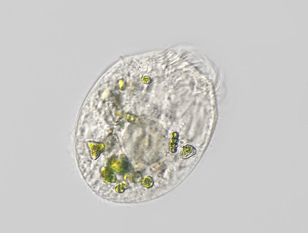ciliat.p96c.jpg