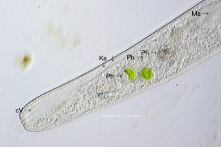 Spirostomum teres: Kontratile Vakuole und Sammelkanal sowie Phagosome.