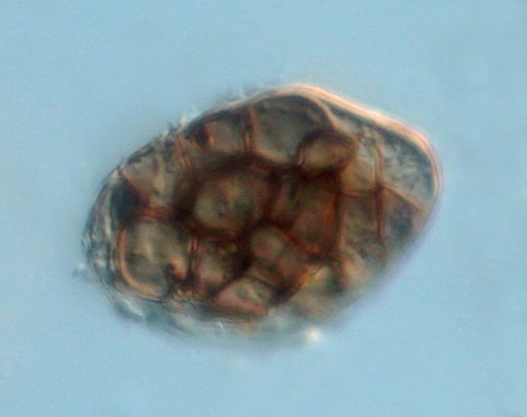 Achromatium oder Arcella.JPG